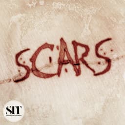 Scars - Udi Harpaz